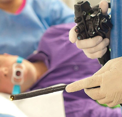 Endoscopia